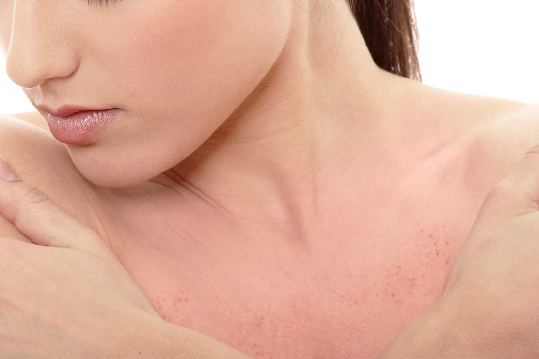 Types of skin allergies