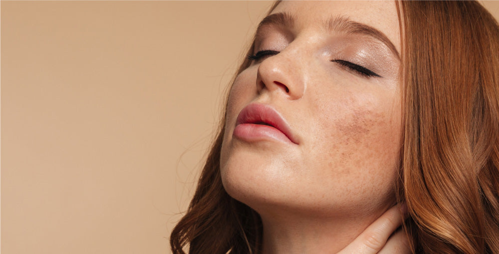 What is melasma and how to treat it?