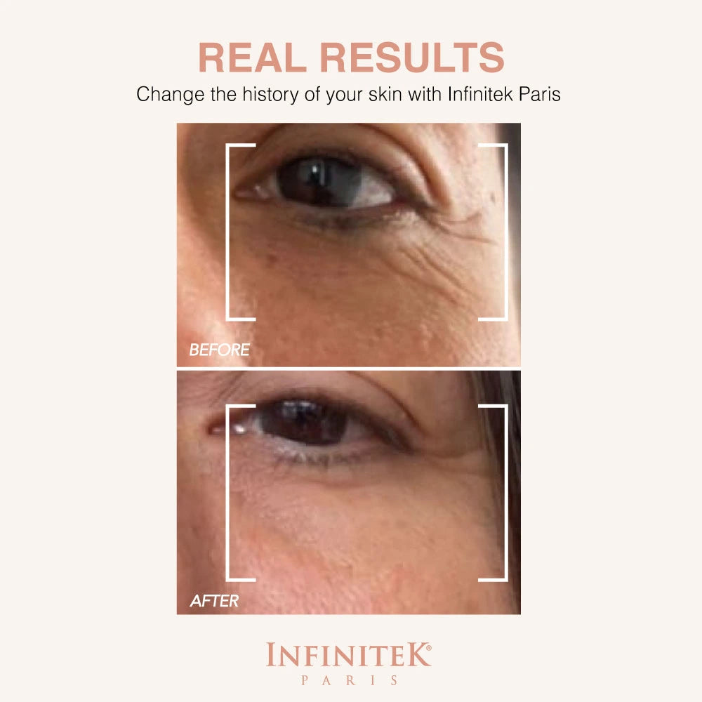 Multi-Active 360 Eye Contour Cream – Infinitek Paris