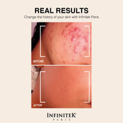 Crema Humectante Retinol