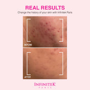 Mascarilla de Barro del Mar Muerto