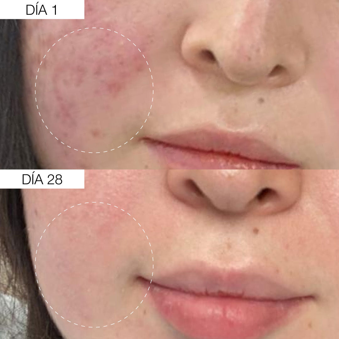 Hyaluronic Acid Serum