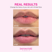 Luxury Lip Balm