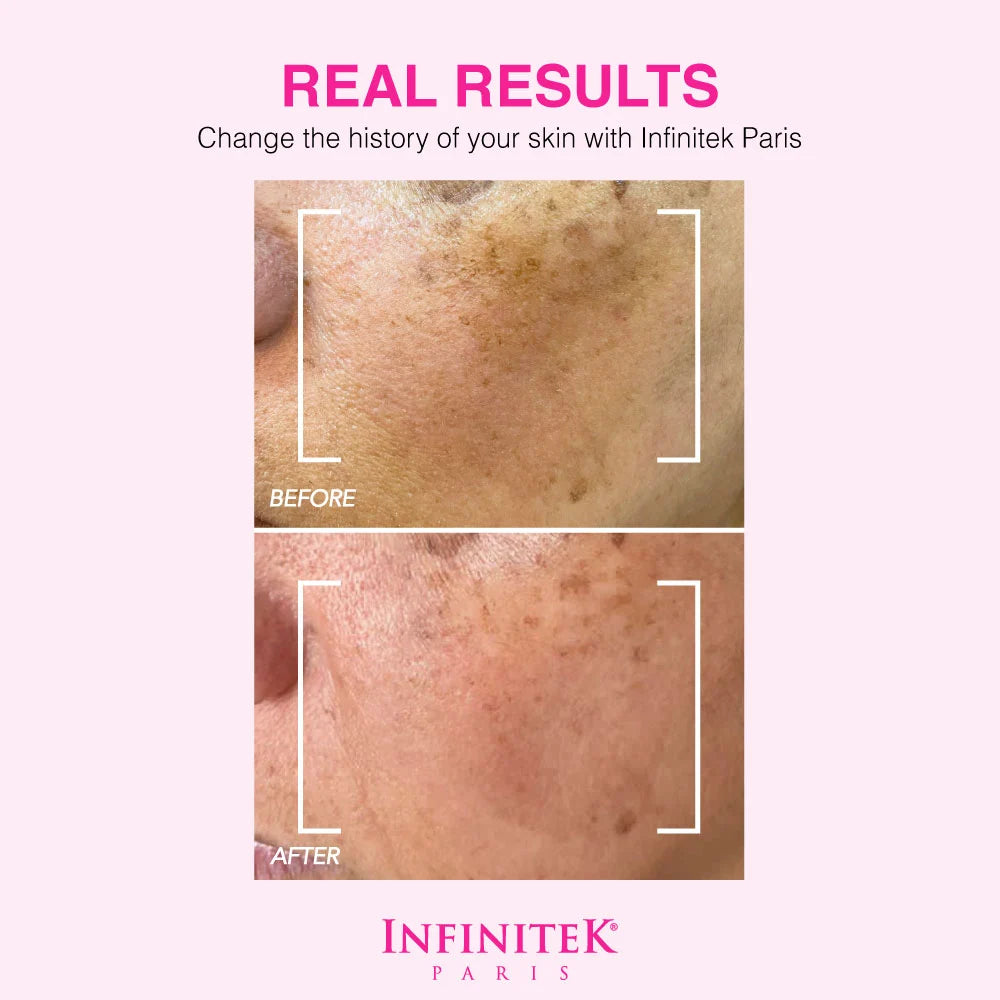 Sérum Clarificante Crystal Rose Con AHA+BHA