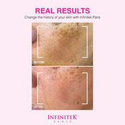 Sérum Clarificante Crystal Rose Con AHA+BHA